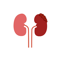 Kidney Cancer